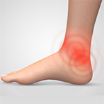Ankle