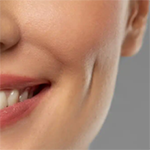 Dimples