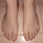 Feet
