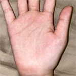 Palm