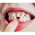 Teeth