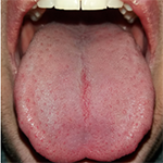 Tongue